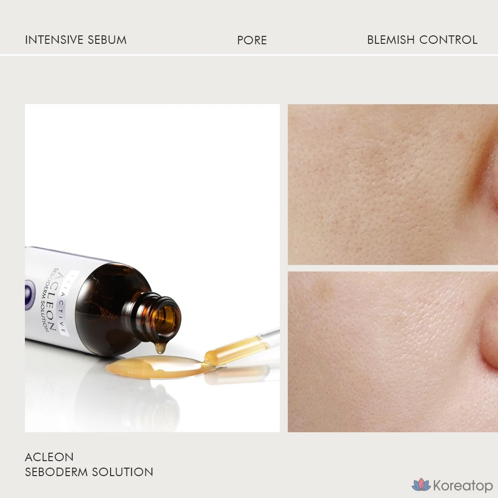 Ампула ANACIS для смягчения кожи при черных точках и угревой сыпи, 2 вида, 1 шт., 255 мл, фото 8