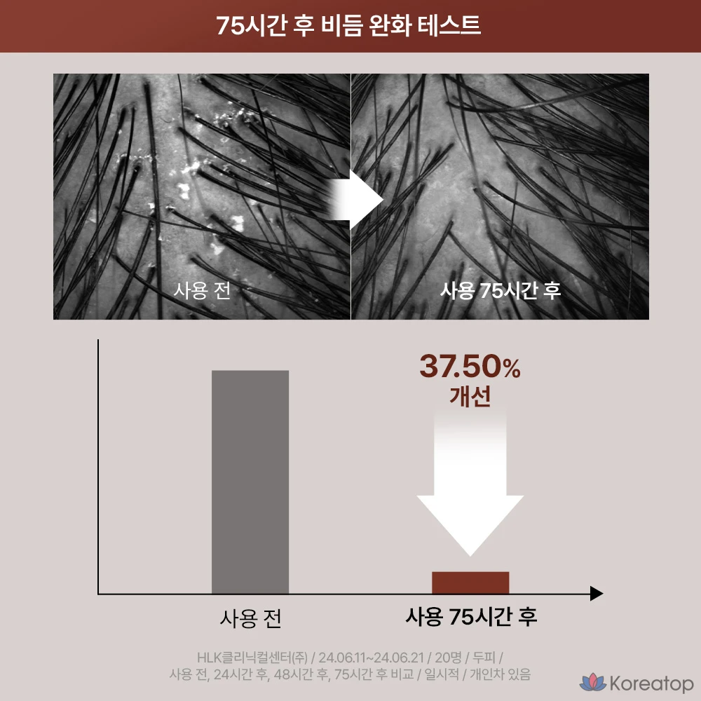 Шампунь от перхоти, 1 флакон (295 г)