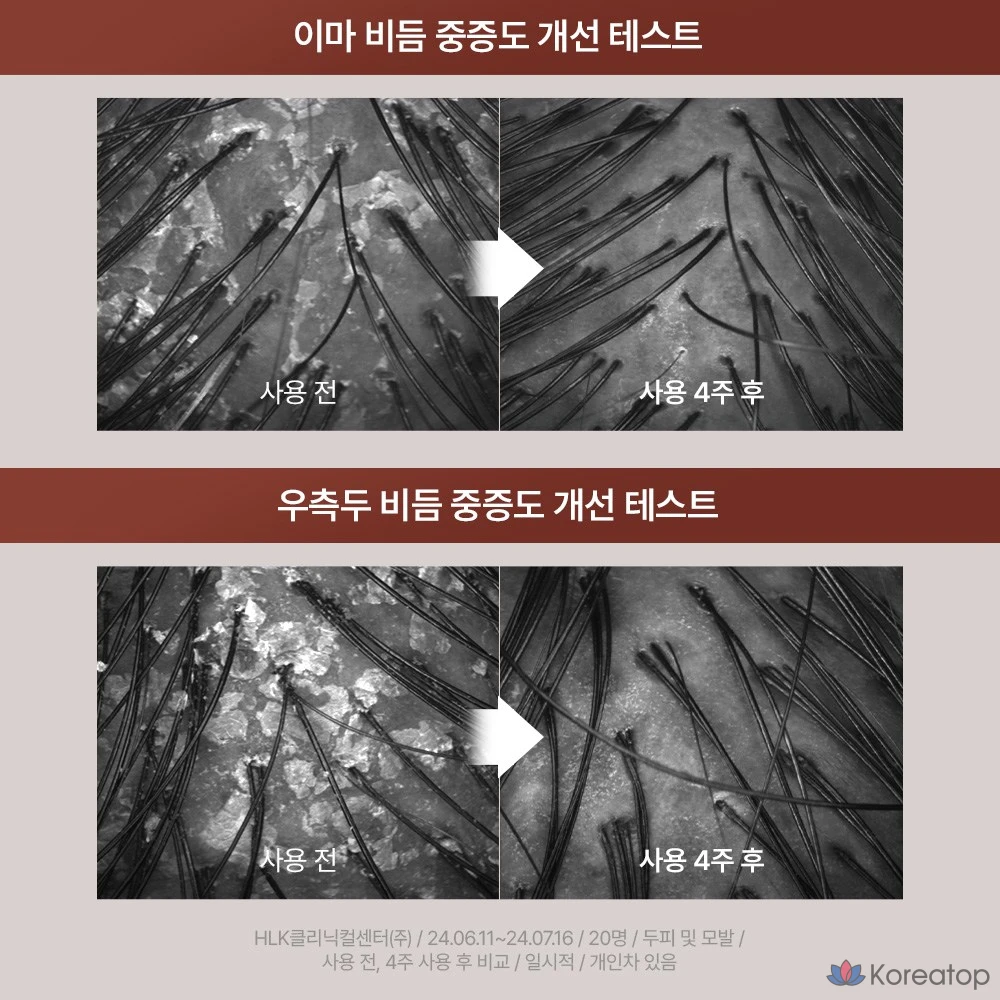 Шампунь от перхоти, 1 флакон (295 г)