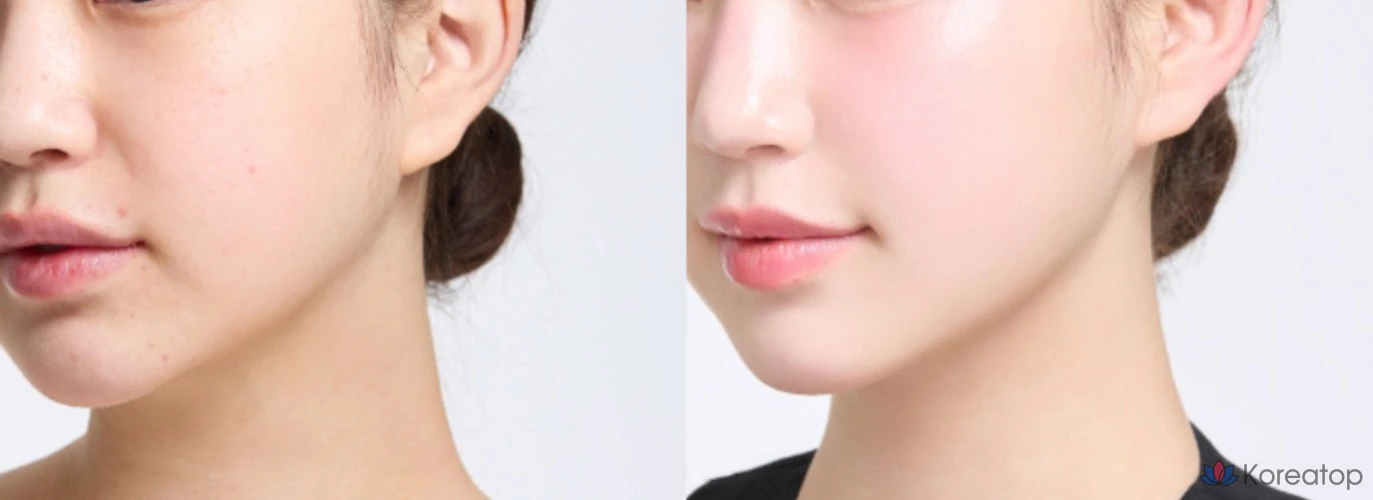 Тональный крем HANSKIN Blemish Cover Comfort Cream Foundation, 30 мл, 1 шт., светло-бежевый., фото 6