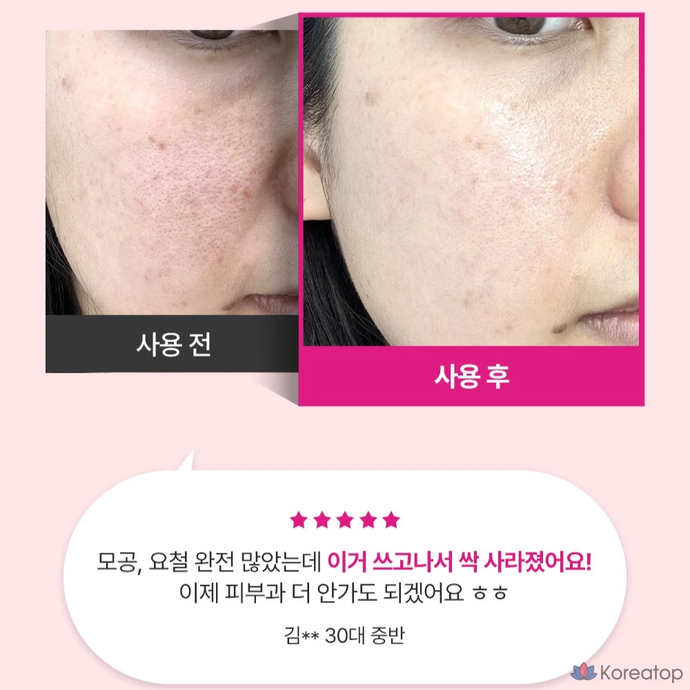 Ампула с гиалуроновой кислотой и экстрактом розового яблока для сужения пор, 30 мл, 1 шт. (Ingredient Editor).