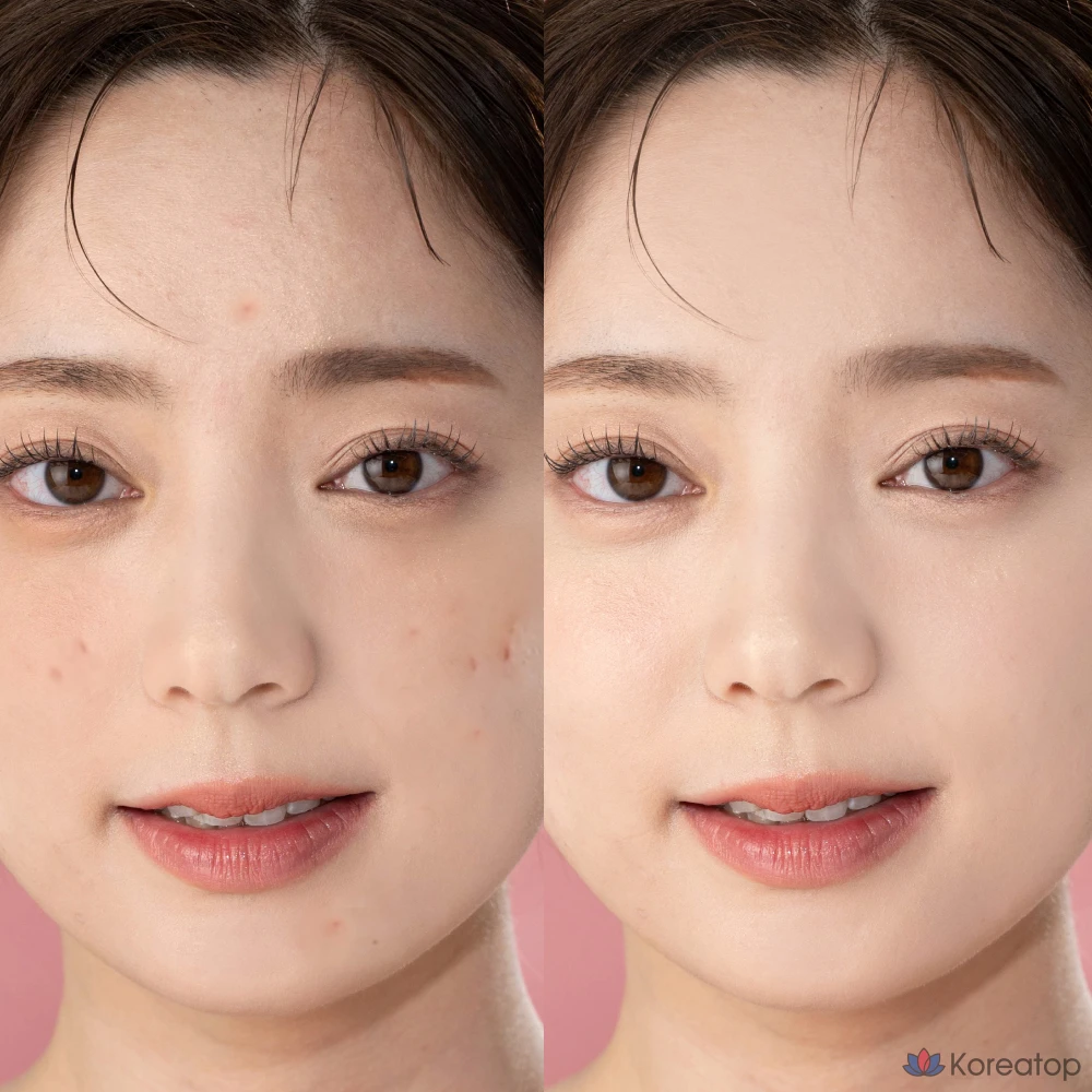 Чехол-накладка Beaudiani Mesh Tight Up Cover Cushion 12 г, Cover Daily No. 02, 1 шт., фото 5