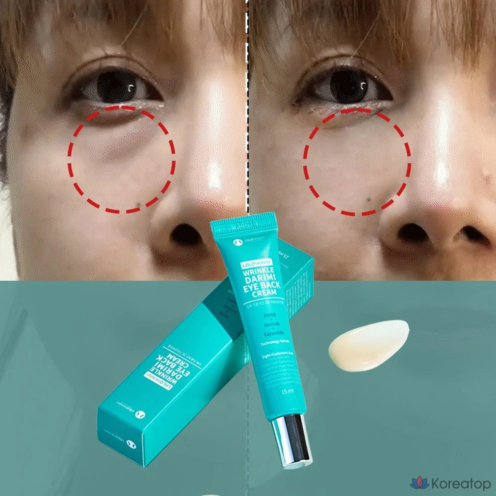 Крем для кожи вокруг глаз для уменьшения жировых отложений, морщин, темных кругов и мешков под глазами, 1 шт., 30 г, фото 5