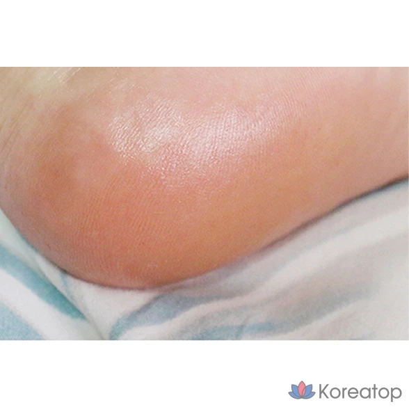 Стик для ухода за ногами Eunyul Silver Feet, 1 шт., 20 г