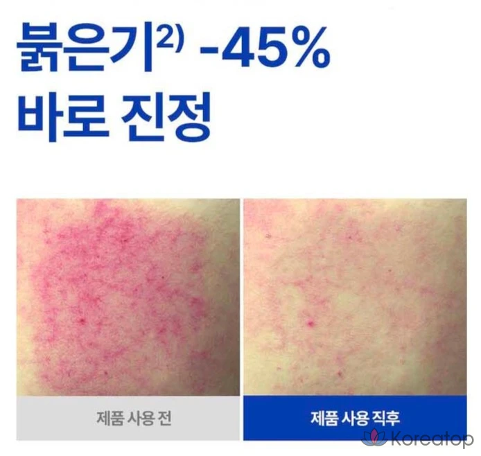 Ампула Isoi Acne Doctor First Speedy Spot, 14 мл, 1 шт., фото 5