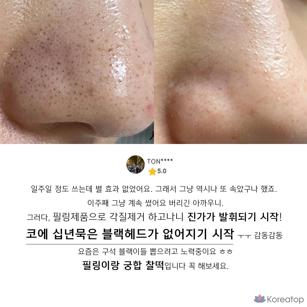 Средство ANACIS для выравнивания тона кожи при черных точках и смягчении пор, ампула, 2 вида, 1 шт., 215 мл