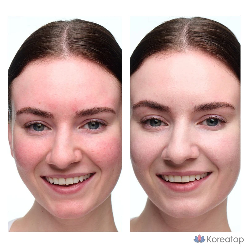 Успокаивающее средство для коррекции цвета волос Dr. Jart+ Cicapair, 15 мл, 1 шт.