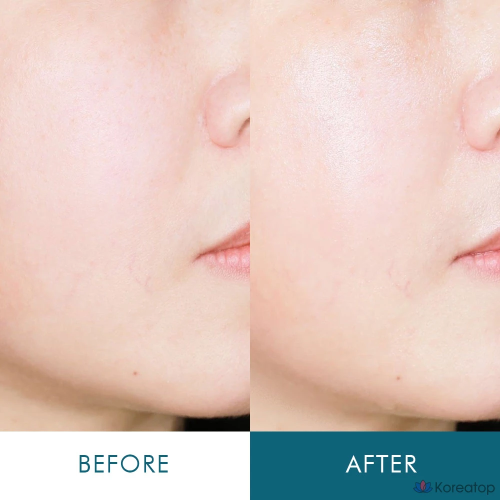 Сыворотка-эссенция ANACIS с коллагеном, керамидами, пантенолом, регенерирующим полимером и гиалуроновой кислотой, против сухости кожи, 1 шт., 55 мл., фото 9