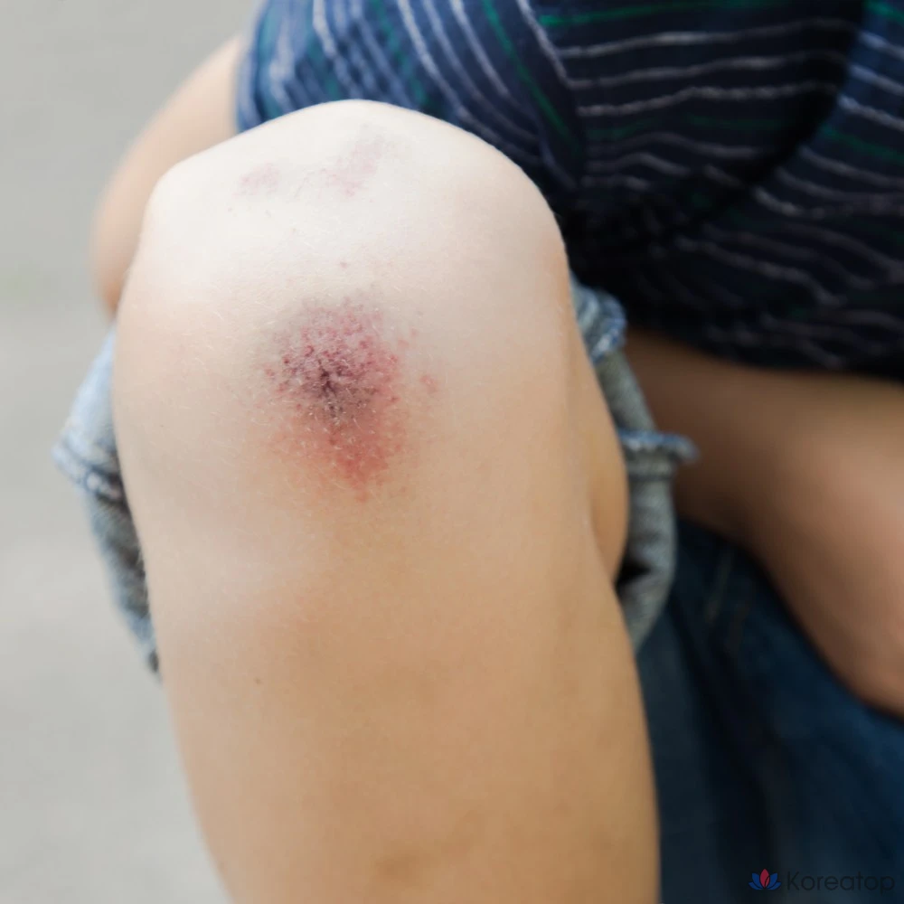 Renoderm Dermal Skin, 10 листов, 1 шт.