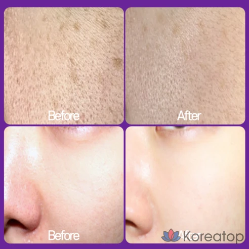 Крем с ретинолом и витамином А RXDerma для разглаживания морщин и отбеливания