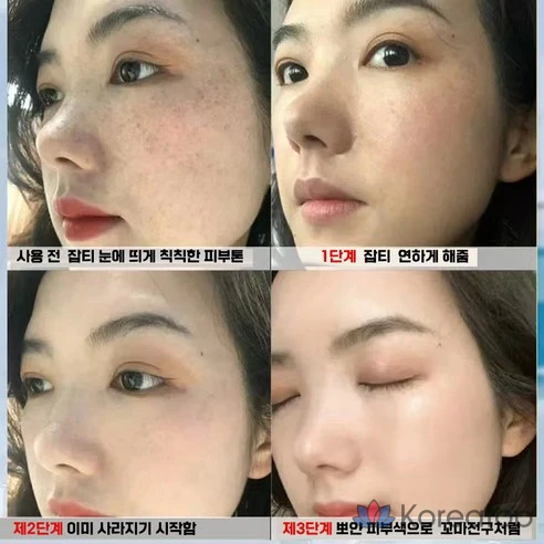 Крем для удаления пигментных пятен и веснушек с мелатонином Perilla Cream, отбеливающий кожу лица, 21 г