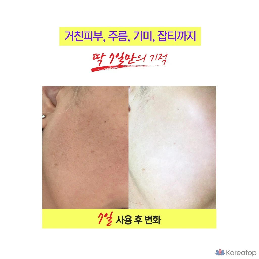 Крем-эссенция YNM с глутатионом, отбеливающим эффектом и гиалуроновой кислотой, антиоксидантный крем-эссенция NMN, 50 мл, 1 шт.