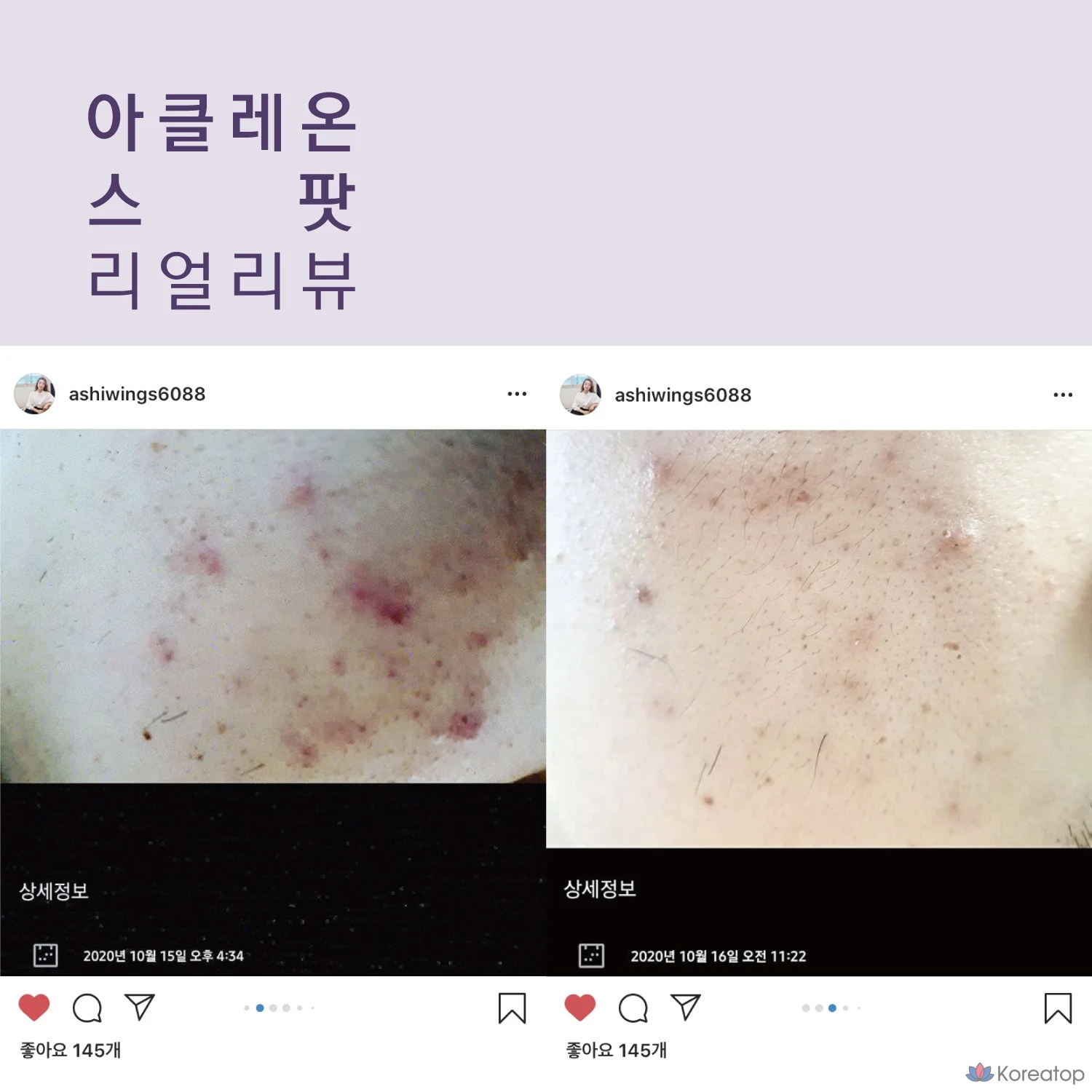 Крем для лица ANACIS Skin Whitehead Trouble Tea Tree Centella Spot, 1 шт., 30 мл