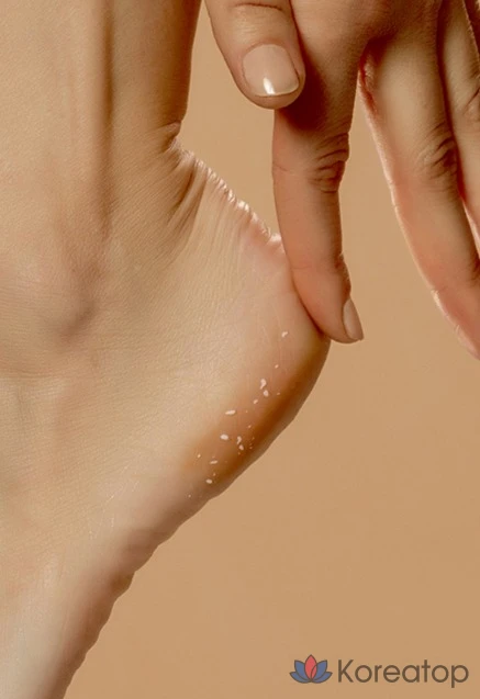 Спрей-пилинг для ног NARD, 1 шт., 1 упаковка