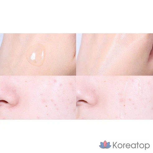 Балансирующий тонер для кожи Acnes DermaRelief, 200 мл