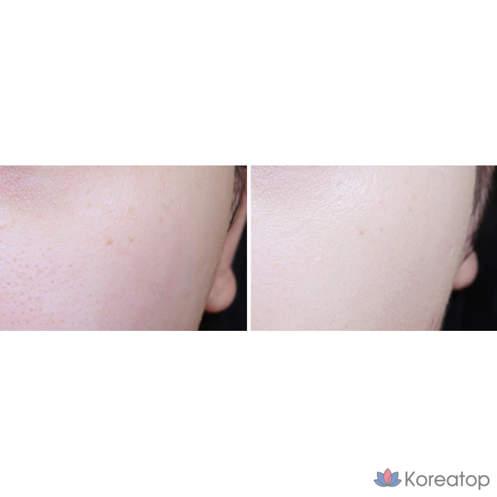 Miba Ion Calcium Mineral BB Cream SPF50+ PA+++, 50 мл, 1 шт., фото 9