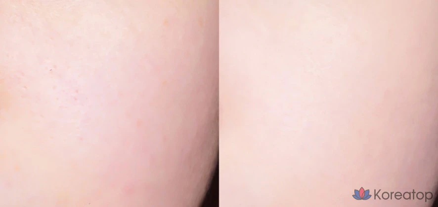 Тональный крем-кушон Lilybyred Cotton Blur, 15 г, № 19, чистый хлопок, 1 шт., фото 2