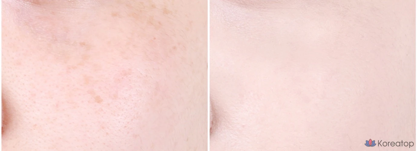 Тональный крем-кушон ABOUT TONE Skin Layer Fit Cushion Foundation, 13 г, оттенок 21 Warm Light, 1 шт., фото 6