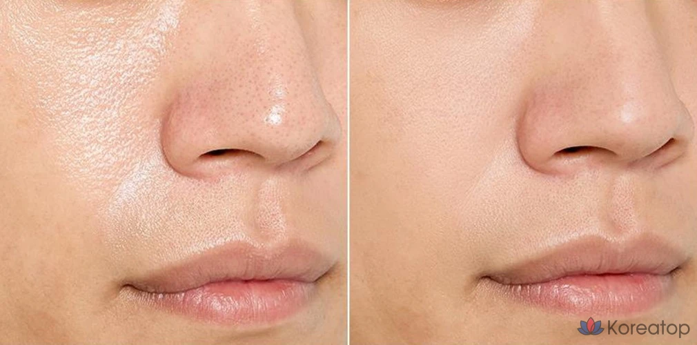 OBge Pore Zero Mousse Clay Pack, 1 упаковка, 2 упаковки, фото 7