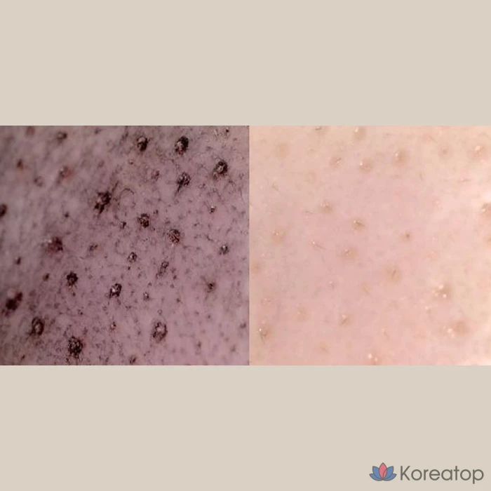 Бальзам-скраб для лица OBge от черных точек, 20 г, 1 шт.