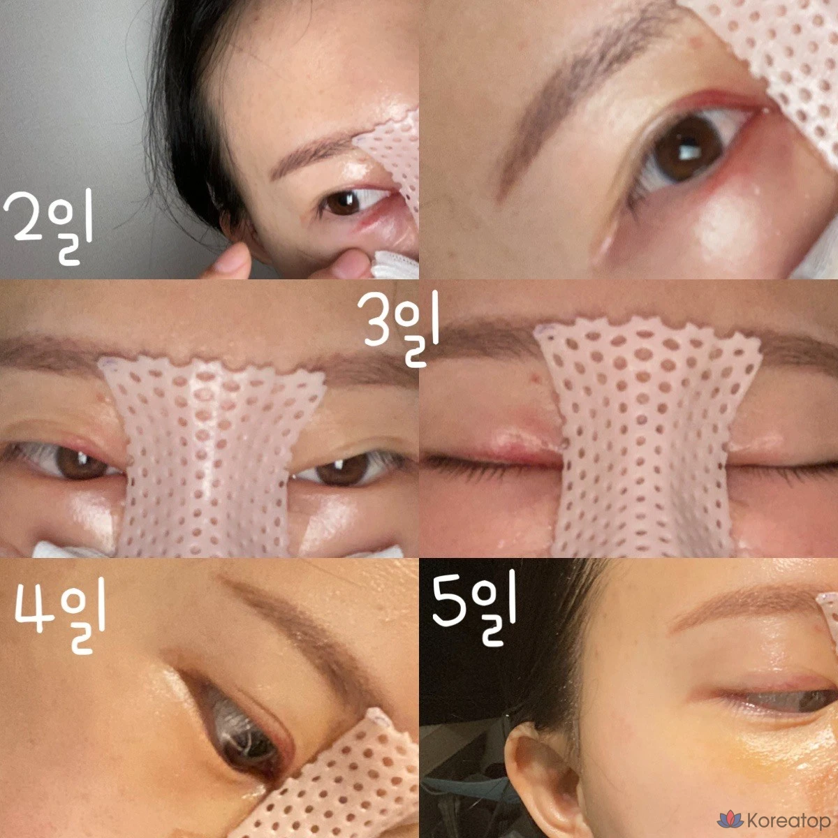 Крем ANACIS K-Oxyderm OP Inmodem с витамином K, 15 мл, 2 упаковки масок Olive Young Mask, 1 упаковка.