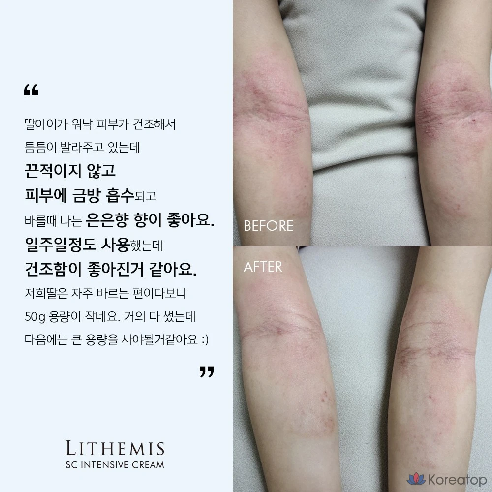 Интенсивный увлажняющий восстанавливающий защитный крем ANACIS 150 г (1 шт.), 50 г (1 шт.), 200 г (1 шт.)