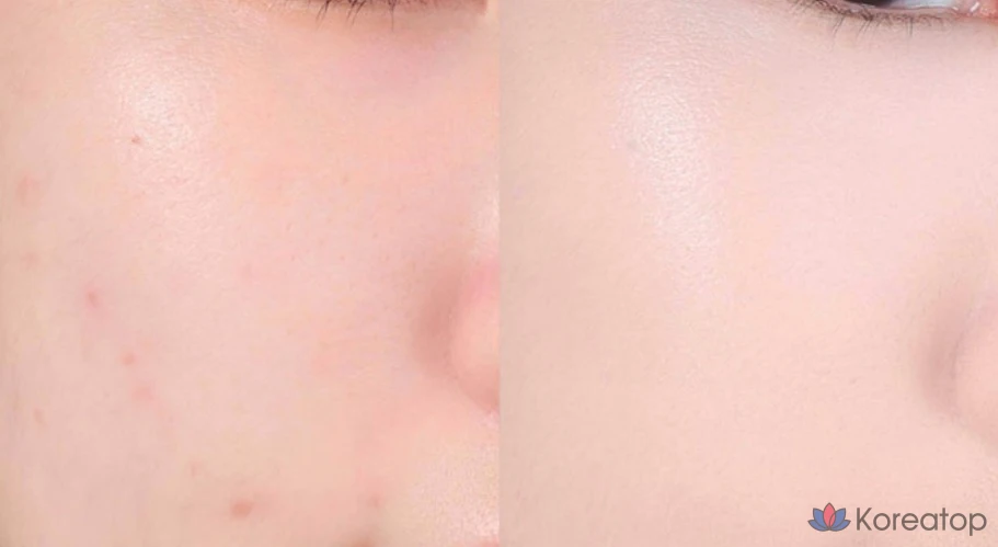 Консилер ABOUT TONE Skin Layer Cover Fit, 5,6 г, 1 шт., 21 оттенок холодного света