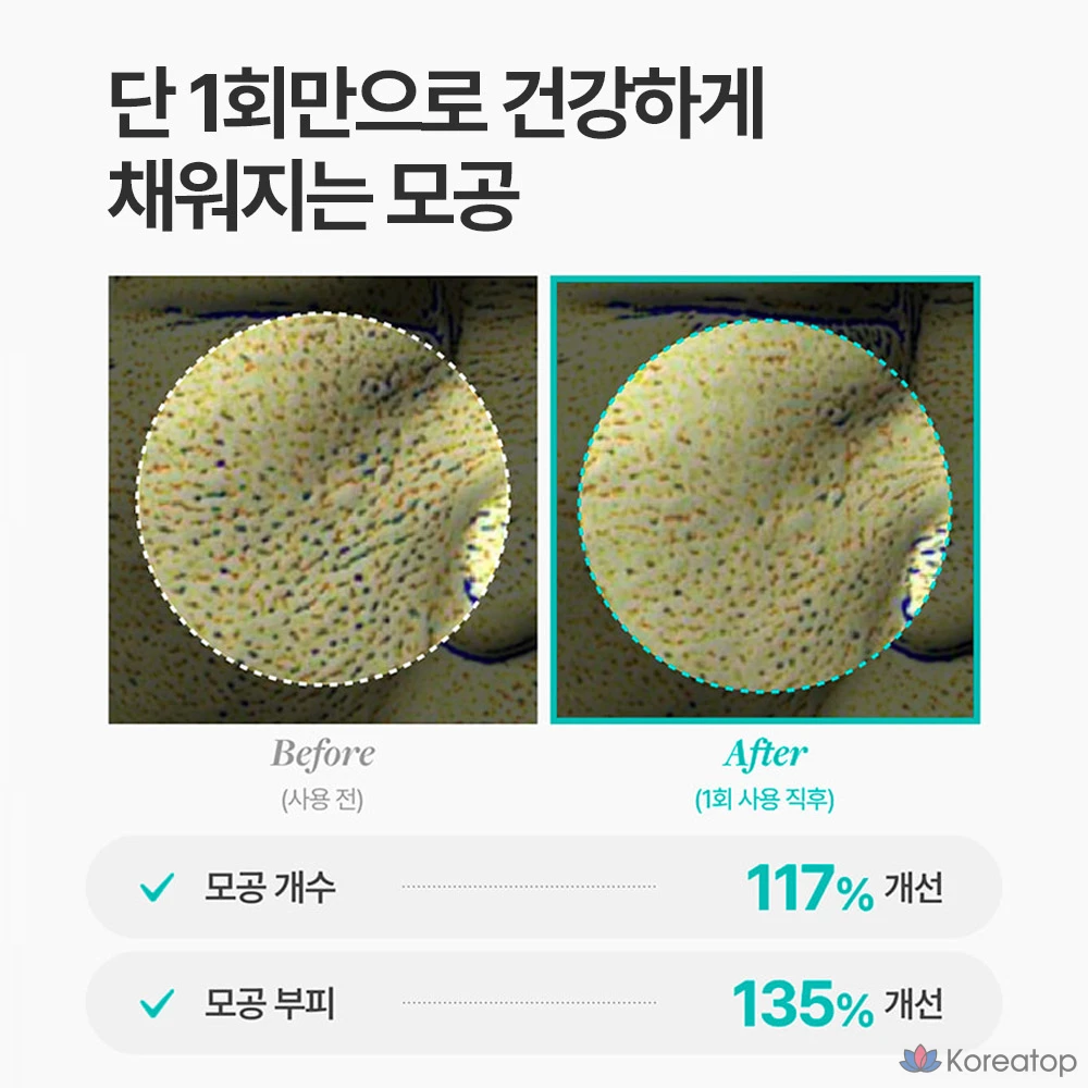 Крем MEDITHERAPY Fossera Real Bifida Blur Cream, 50 мл, 1 шт.