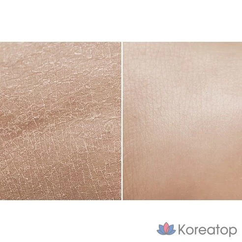 Пилинг-гель для лица Healseed Amazing Aqua, 150 мл