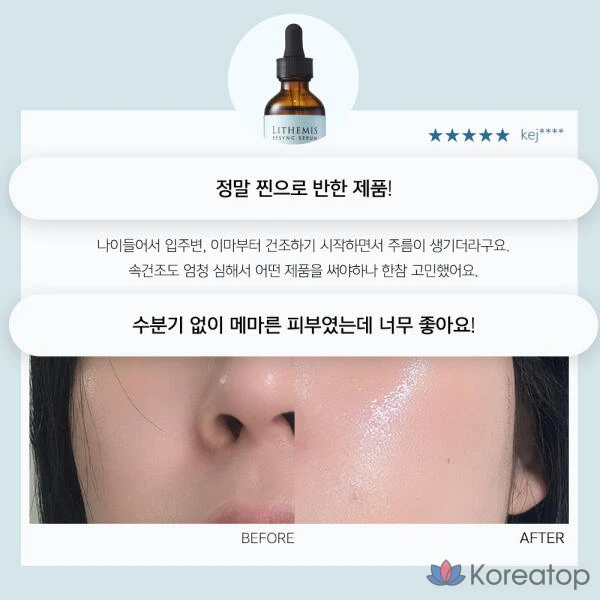 Artbox/ANACIS Leadermiss Resync Средство от акне с гиалуроновой кислотой в ампулах, 55 мл, 1 шт., 20 мл