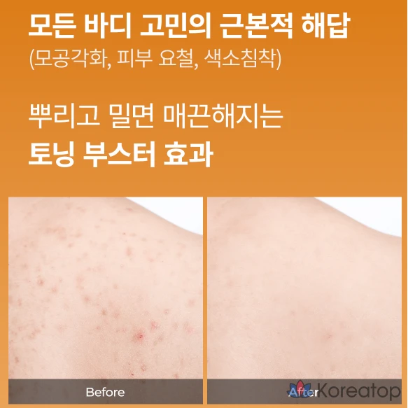 Пилинг Dr. Melaxin Peel Shot Kojic Acid Turmeric Spray, 200 мл, 1 шт.