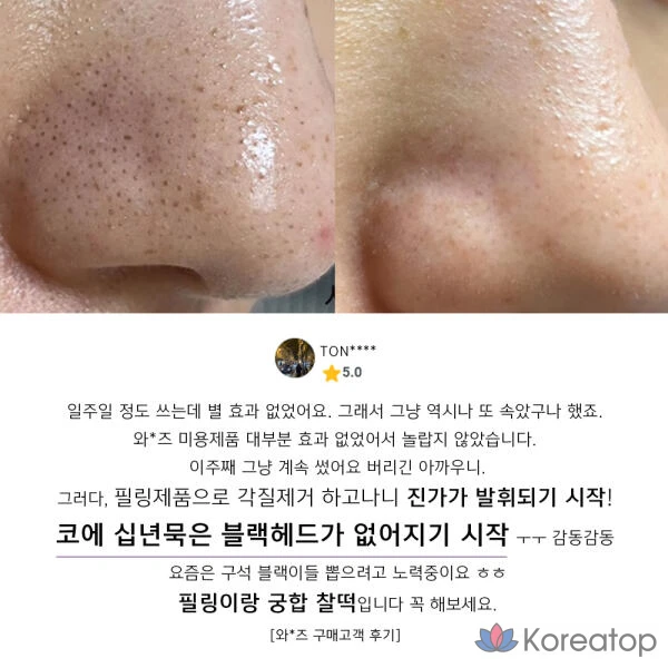 Artbox/ANACIS Acleon Sebo Extractor 1000 мл, 1 бутылка, 1 л, фото 4