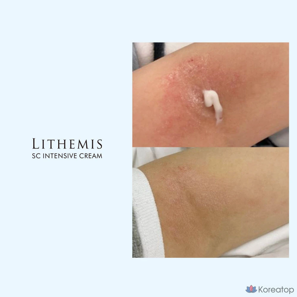 Интенсивный увлажняющий восстанавливающий защитный крем ANACIS 150 г (1 шт.), 50 г (1 шт.), 200 г (1 шт.)