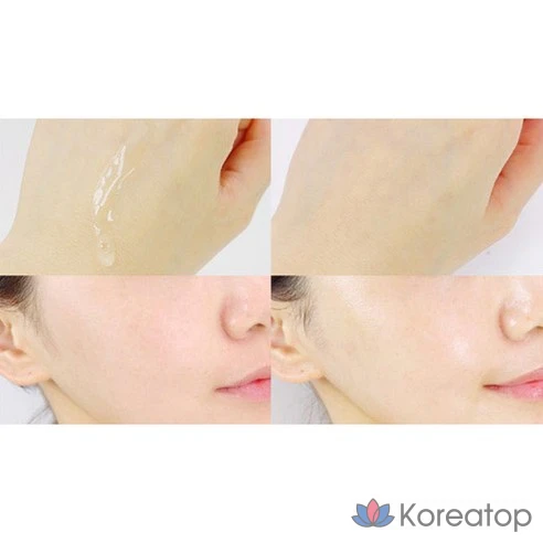 Балансирующий тонер для кожи Acnes DermaRelief, 200 мл