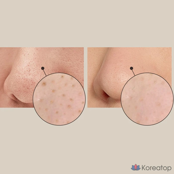 Бальзам-скраб для лица OBge от черных точек, 20 г, 1 упаковка, 3 шт., фото 6