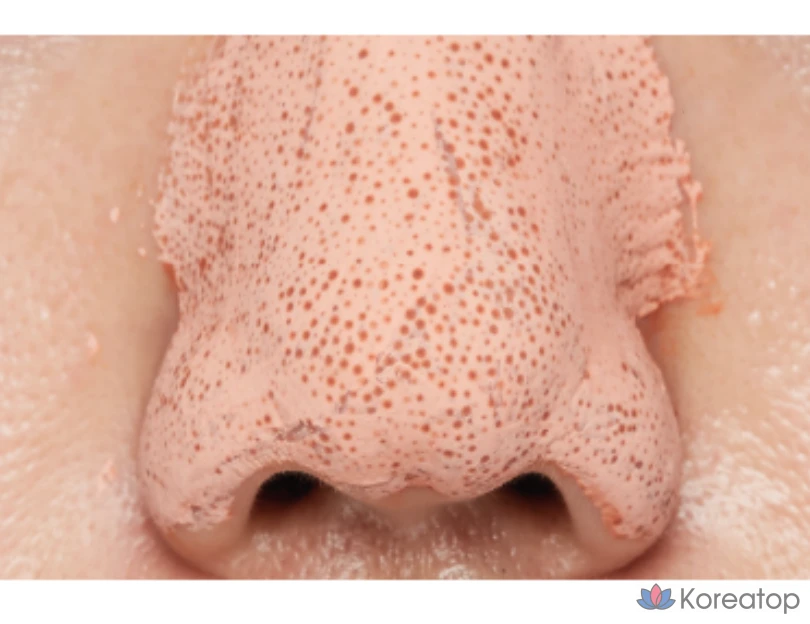 Маска для сужения пор Missha Amazon Red Clay, 110 мл, 1 упаковка, 3 упаковки, фото 8