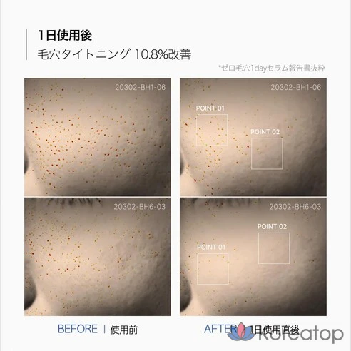 30 мл [Medicube] Сыворотка для сужения пор на один день 30 мл [Medicube] Сыворотка для сушения пор на один день, 1 шт.