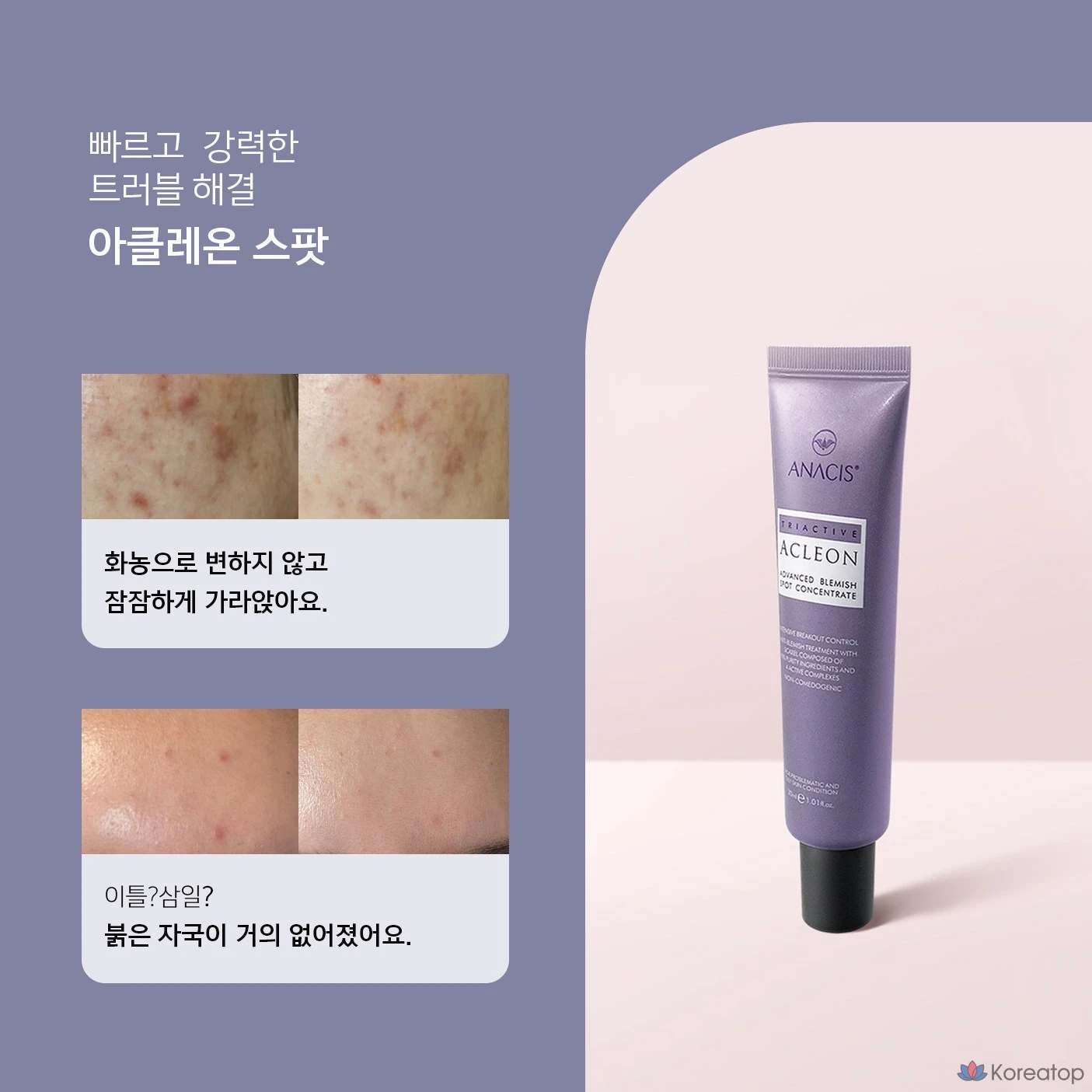 Крем для лица ANACIS Skin Whitehead Trouble Tea Tree Centella Spot, 1 шт., 30 мл