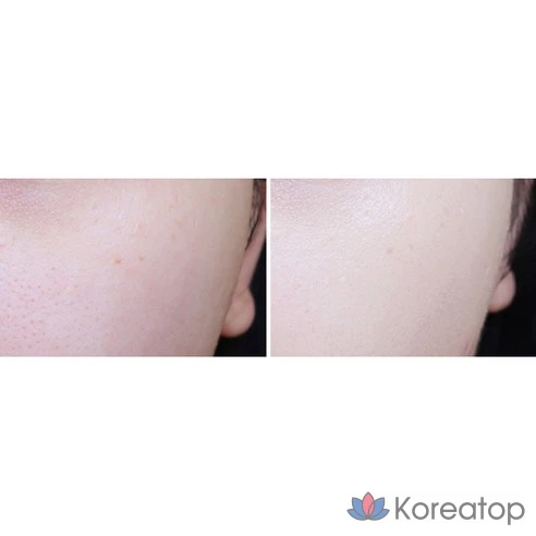 Минеральный BB крем с ионами кальция и SPF50+ Miba