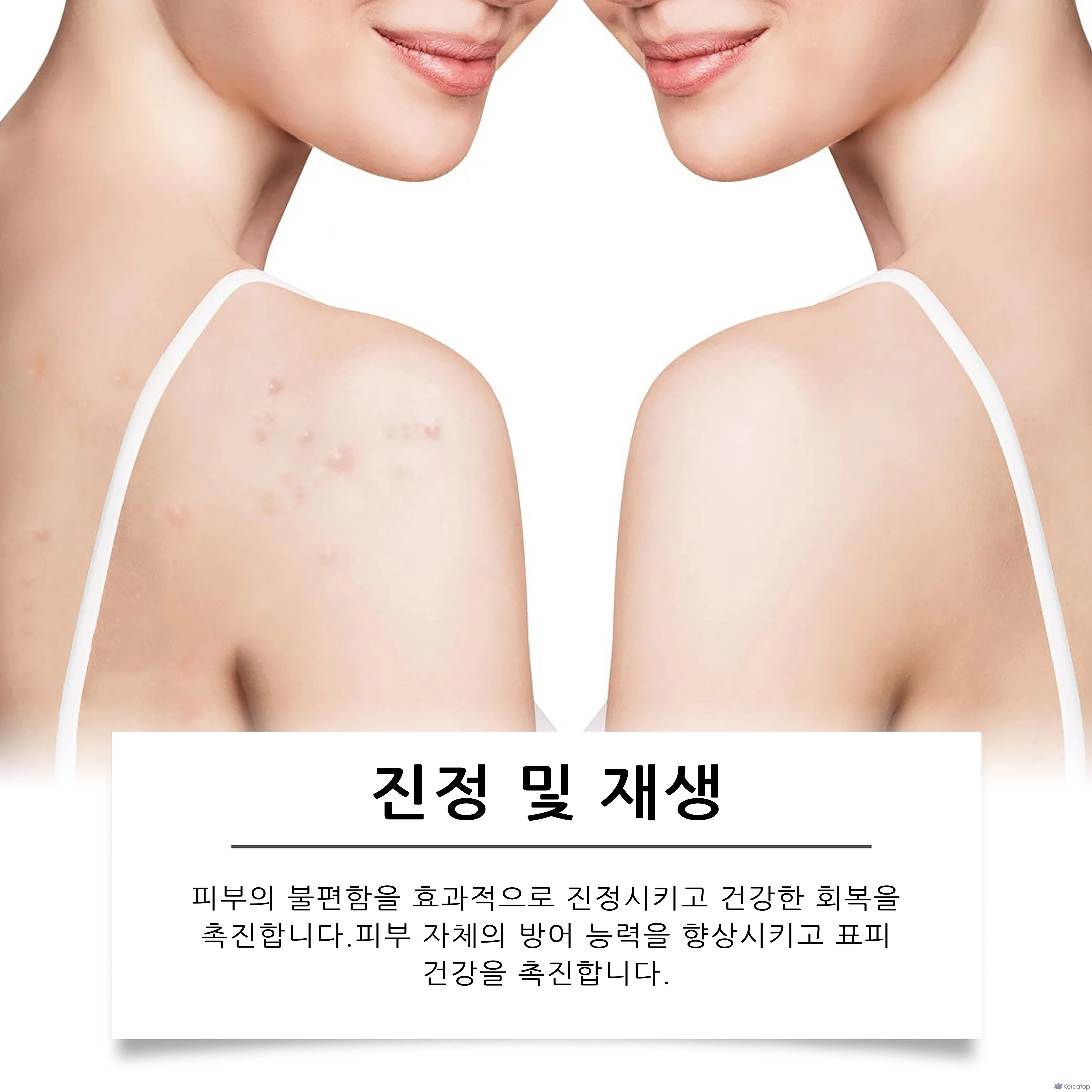 Крем для регенерации кожи Madeca с экстрактом центеллы азиатской, высококонцентрированный отбеливающий крем, интенсивное увлажнение, разглаживание морщин, успокаивающее увлажнение, уход после лазерной эпиляции, восстанавливающий дневной крем, 1 шт., 50 г, фото 5