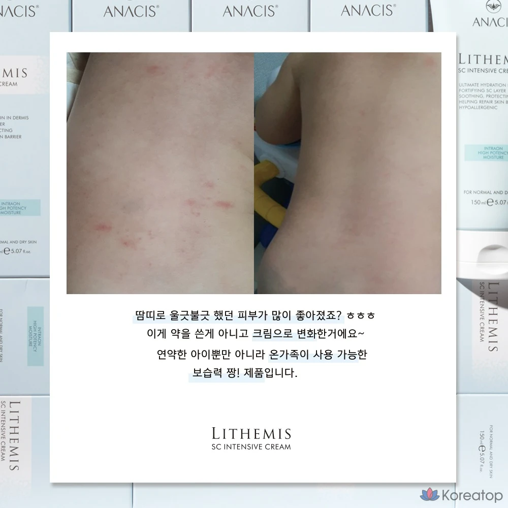 Интенсивный увлажняющий восстанавливающий защитный крем ANACIS 150 г (1 шт.), 50 г (1 шт.), 200 г (1 шт.)