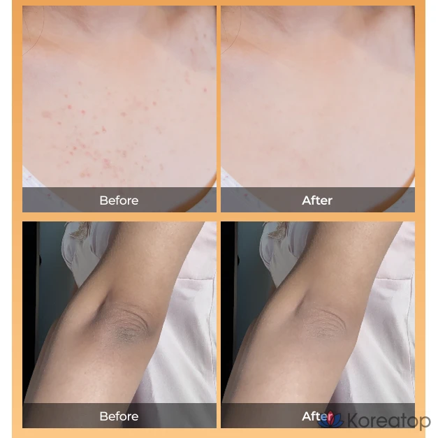 Пилинг Dr. Melaxin Peel Shot Kojic Acid Turmeric Spray, 200 мл, 1 шт.