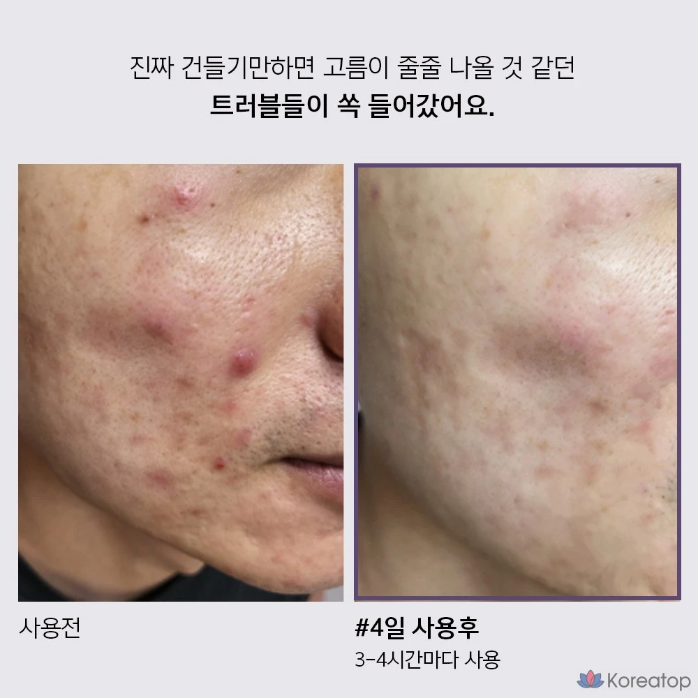 Крем для лица ANACIS Skin Whitehead Trouble Tea Tree Centella Spot, 1 шт., 30 мл