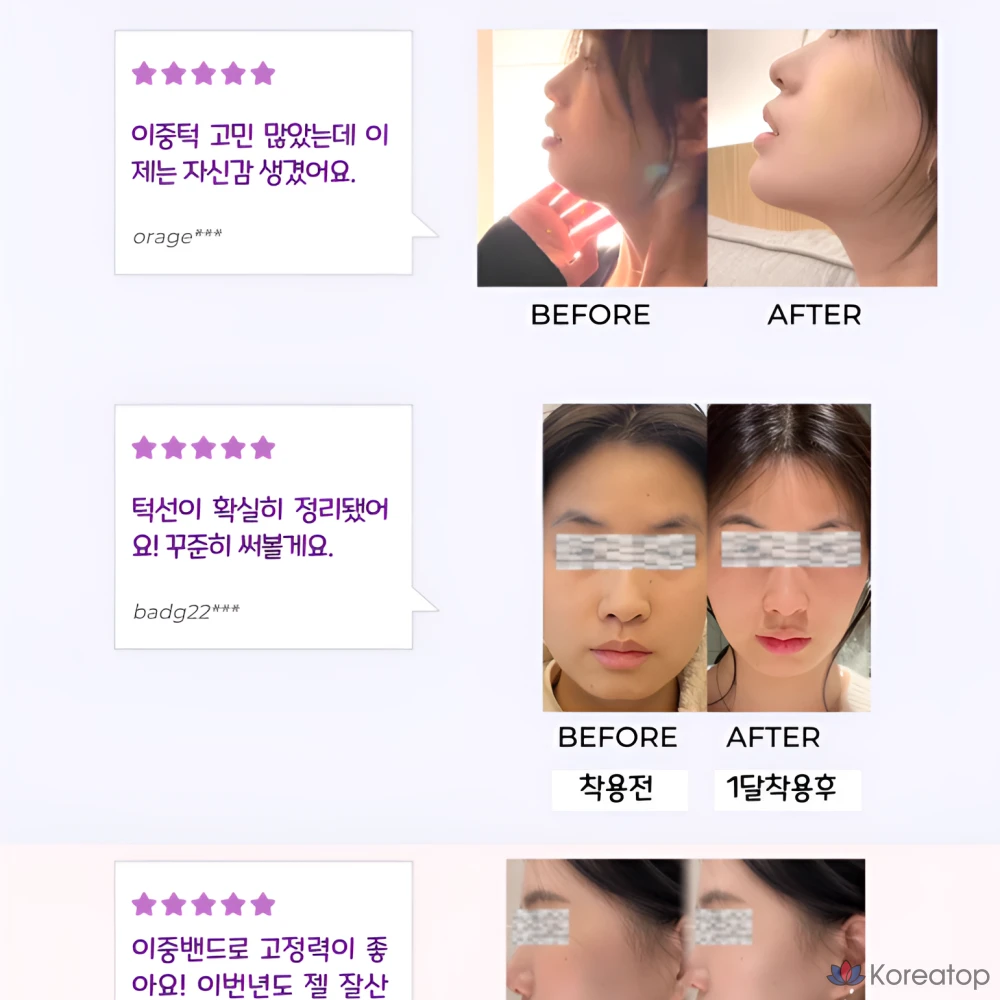 Эластичная лента для подтяжки подбородка Shine Root V-Line, 1 шт.