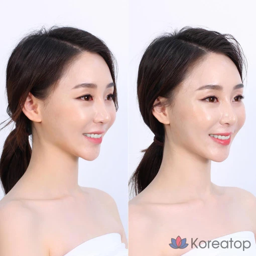 Спрей для лица Rubelli Water Glow Essence Radiance Mist, 80 мл, 1 шт.