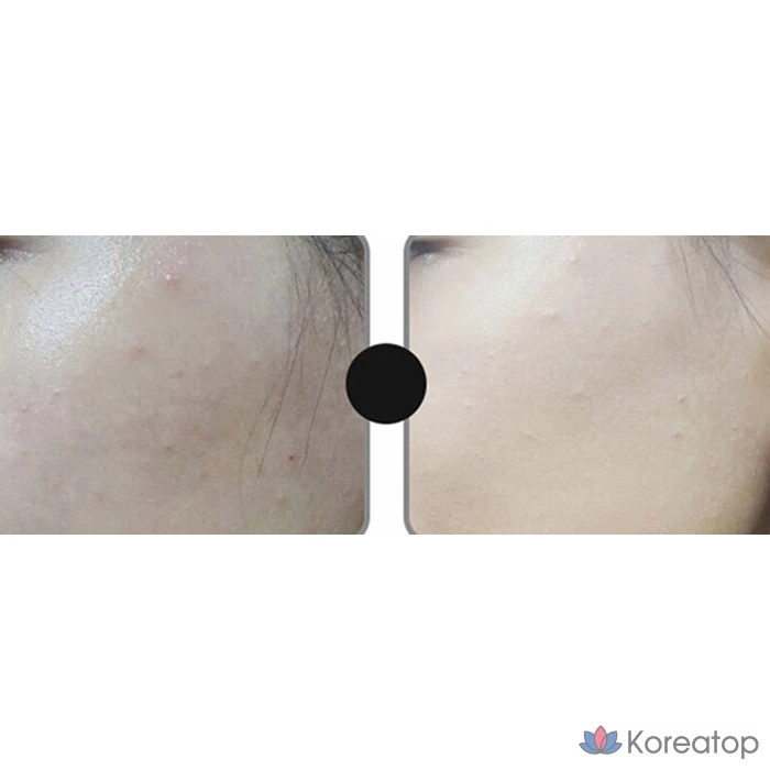 Тональный крем-стик Roseang 6 г, № 19 Baby Beige, 1 шт., фото 5