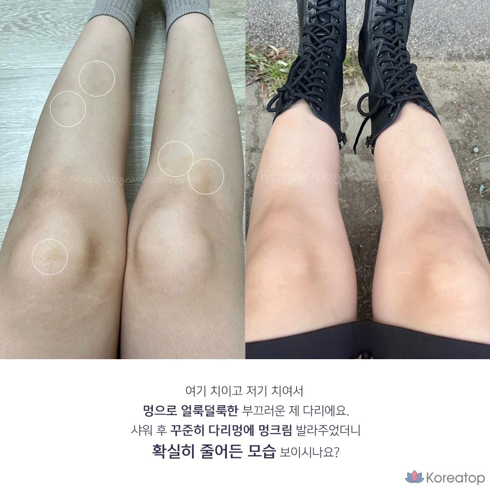 Крем ANACIS K-Oxyderm OP Inmodem с витамином K, 15 мл, 2 упаковки масок Olive Young Mask, 1 упаковка.