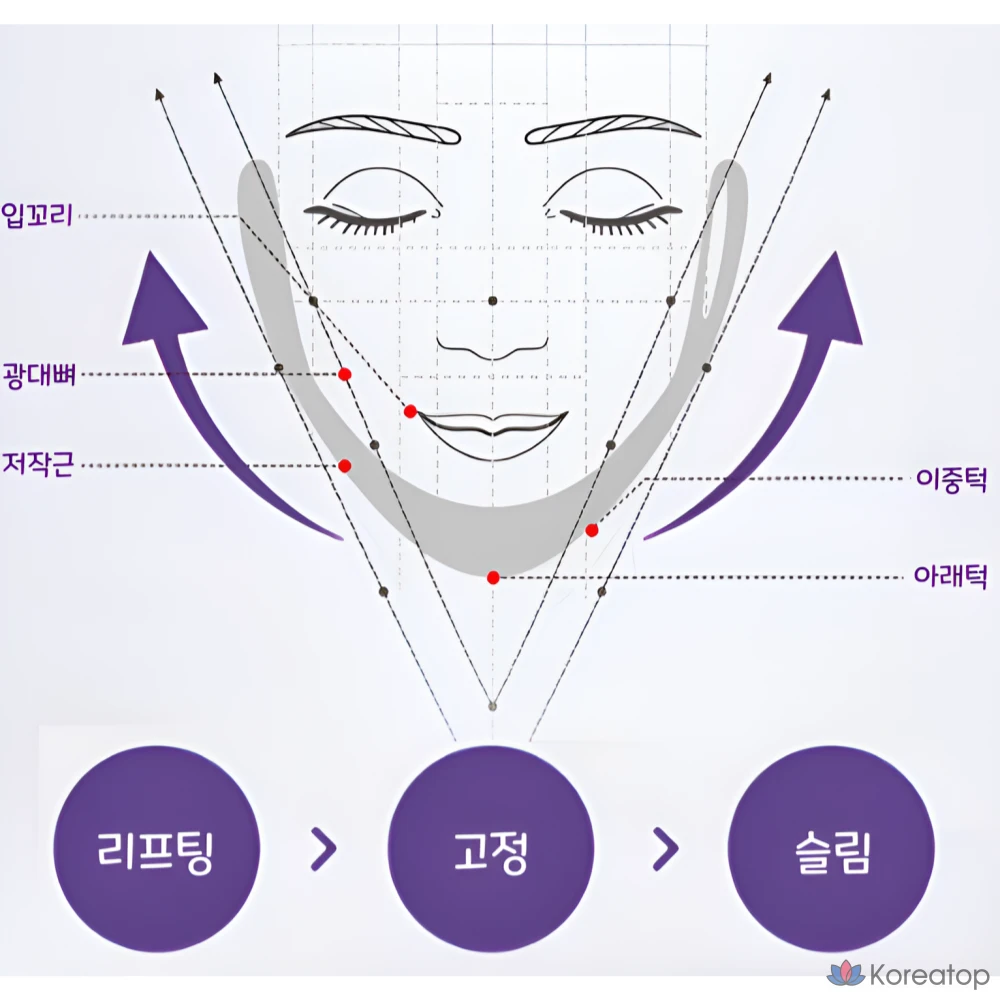Эластичная лента для подтяжки подбородка Shine Root V-Line, 1 шт.