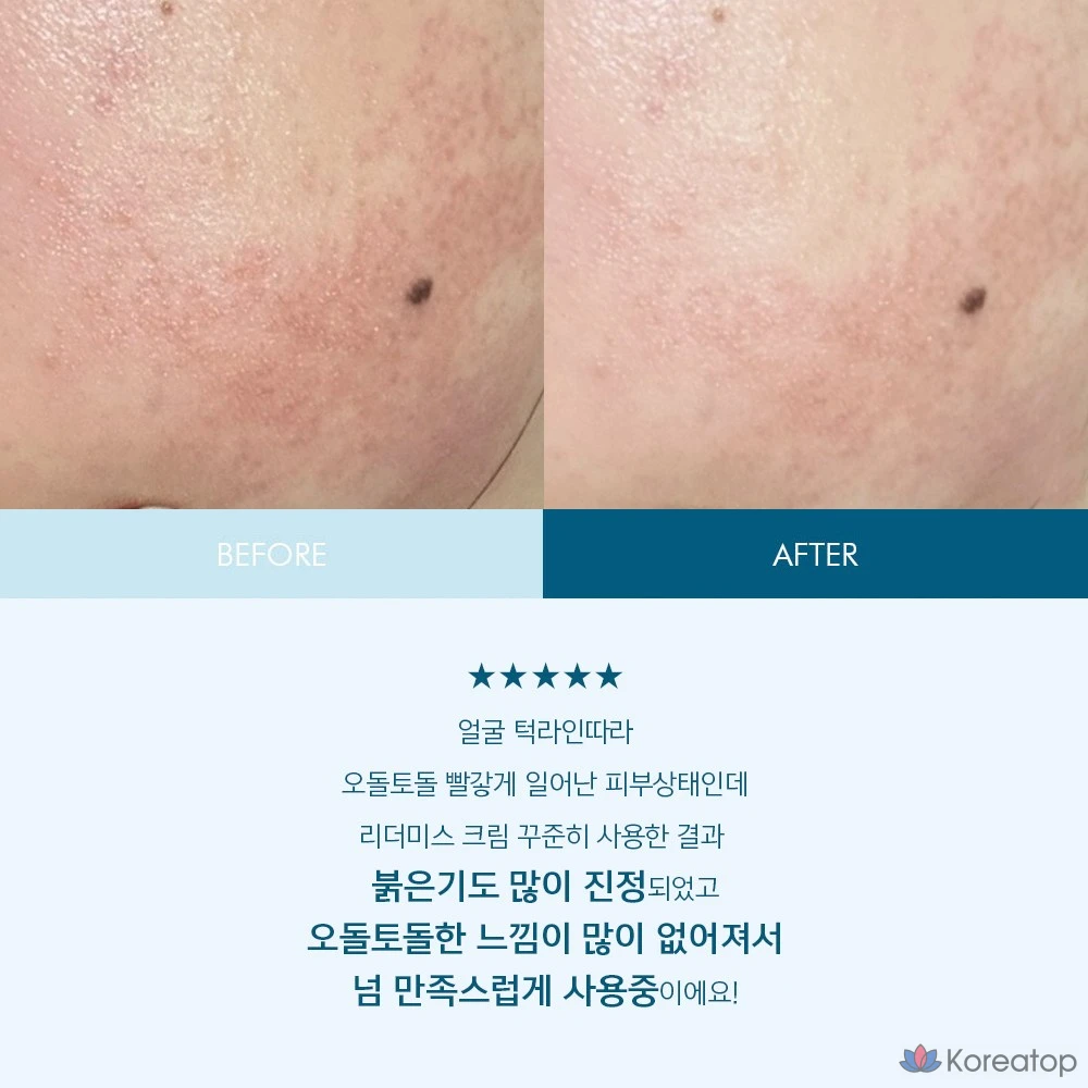 Интенсивный увлажняющий восстанавливающий защитный крем ANACIS 150 г (1 шт.), 50 г (1 шт.), 200 г (1 шт.)