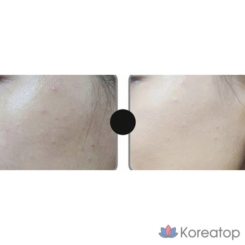 Тональная основа Roseang Stick Foundation 6 г, № 23 бежевый